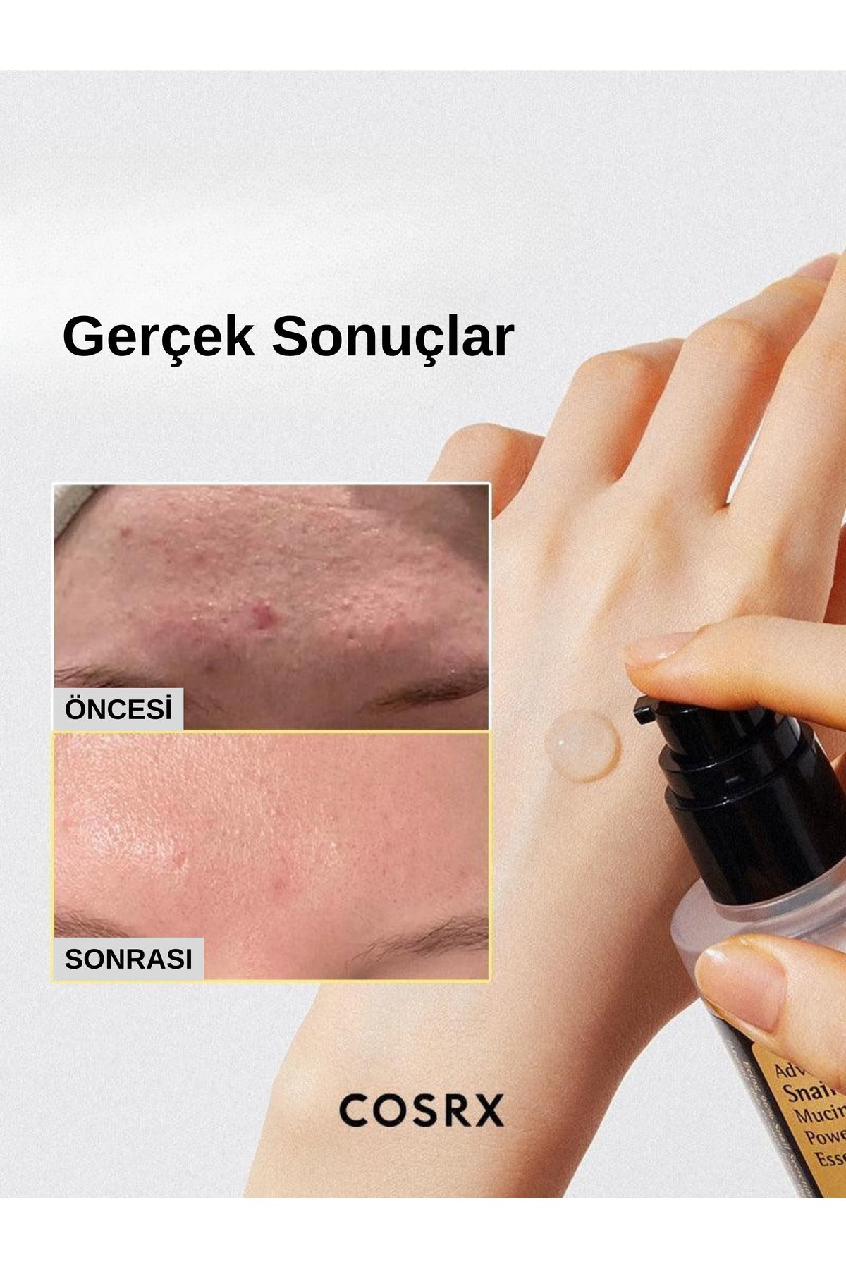 Salyangoz Özlü Nemlendirici Esans 100ml | COSRX Advanced Snail 96 Mucin Power Essence | Onarıcı Cilt Bakım